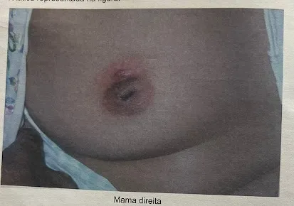 Imagem da questão
