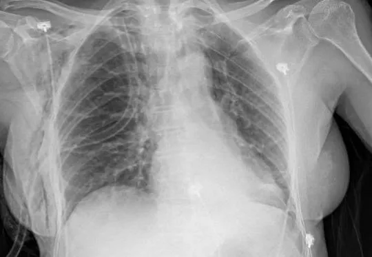 Imagem da questão