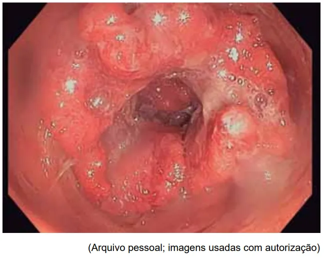 Imagem da questão