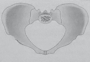 Imagem b